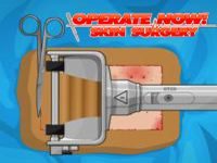 Игра Операция: пересадка кожи